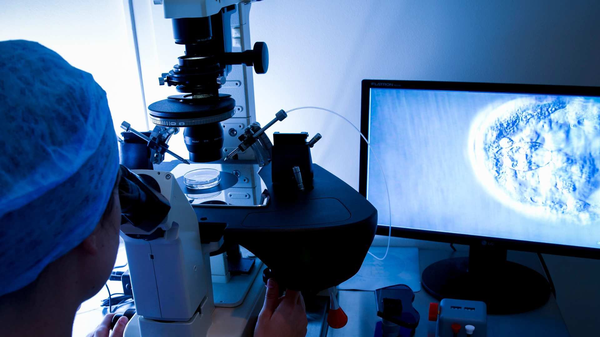 Fertilizare in Vitro